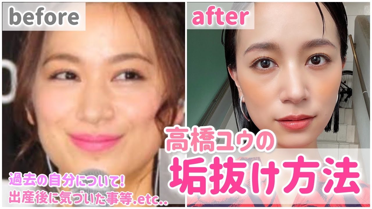 【垢抜け】5年間で垢抜けできた方法をお伝えします