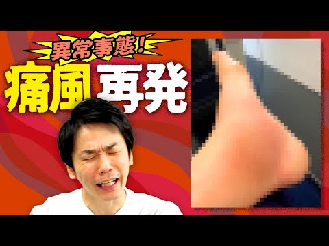 【痛風再発】かまいたち濱家の足に異常事態発生！