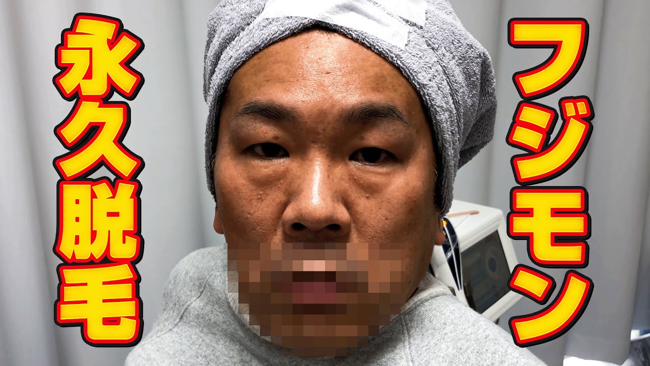 【初体験】藤本敏史51歳、初めての永久脱毛