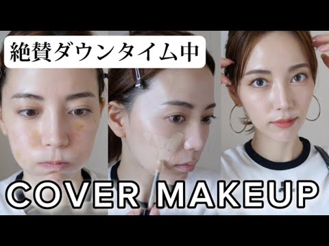 【雑談GRWM】ダウンタイム中に綺麗に見せるベースメイクのコツ